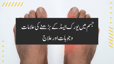 symptoms causes and treatment of increased uric acid symptoms causes and treatment of increased uric acid